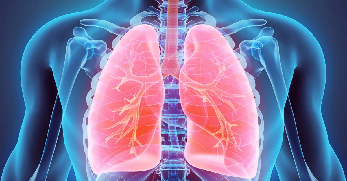 Tromboembolismo Pulmonar: Entendendo a Condição