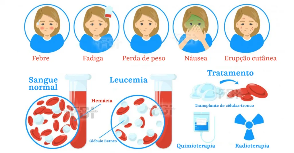 Alerta Importante: Sinais de Leucemia que Demandam Atenção Imediata