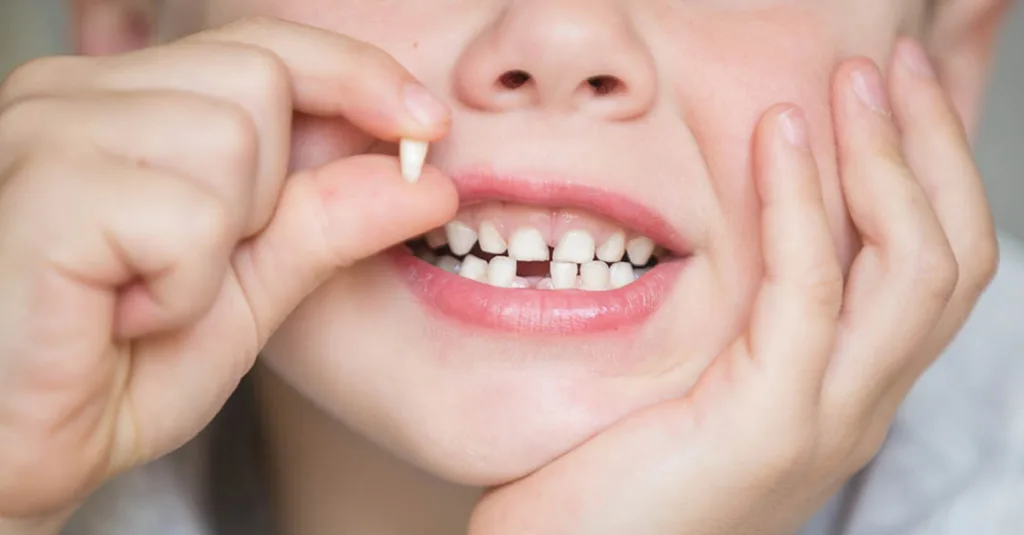 Guardando uma Esperança: Dentistas Alertam sobre o Potencial Salvador dos Dentes de Leite