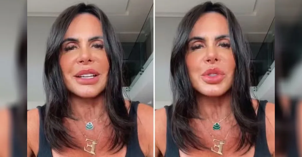 Gretchen revela novo visual após procedimento estético Rosto mais fino e radiante